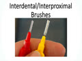 Using the Interproximal Aid